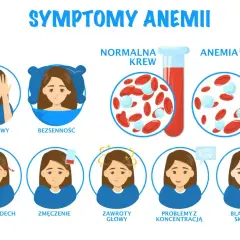 Niedobór żelaza objawy neurologiczne: bóle głowy, bezsenność, zawroty głowy, problemy z koncentracją.