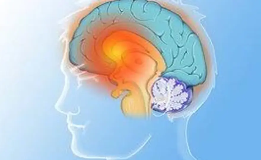 Choroba Huntingtona - objawy, diagnostyka i rehabilitacja