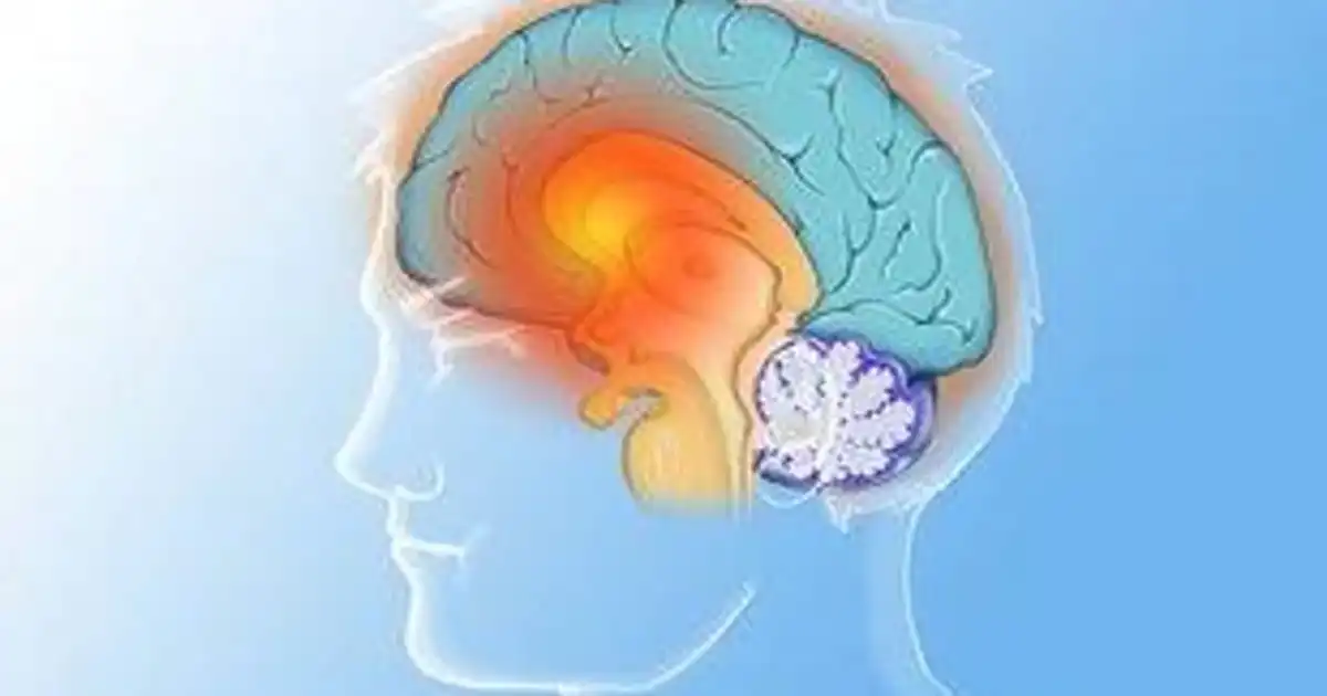 Choroba Huntingtona - objawy, diagnostyka i rehabilitacja