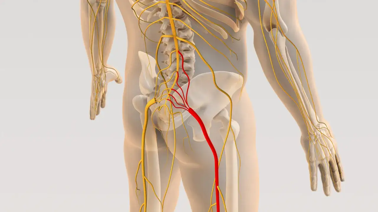 Anatomia układu nerwowego, z zaznaczonym na czerwono nerwem, kt&oacute;ry może być objęty stenoza kanału kręgowego.