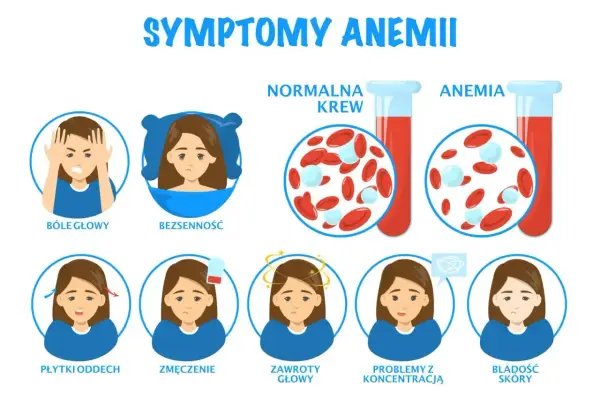Niedobór żelaza objawy neurologiczne: bóle głowy, bezsenność, zawroty głowy, problemy z koncentracją.